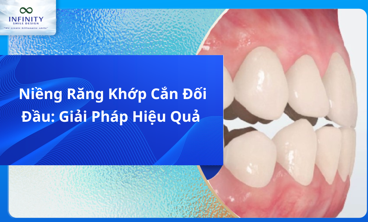 Niềng Răng Khớp Cắn Đối Đầu: Giải Pháp Hiệu Quả