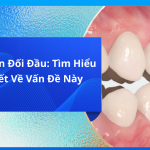 Khớp Cắn Đối Đầu: Tìm Hiểu Chi Tiết Về Vấn Đề Này