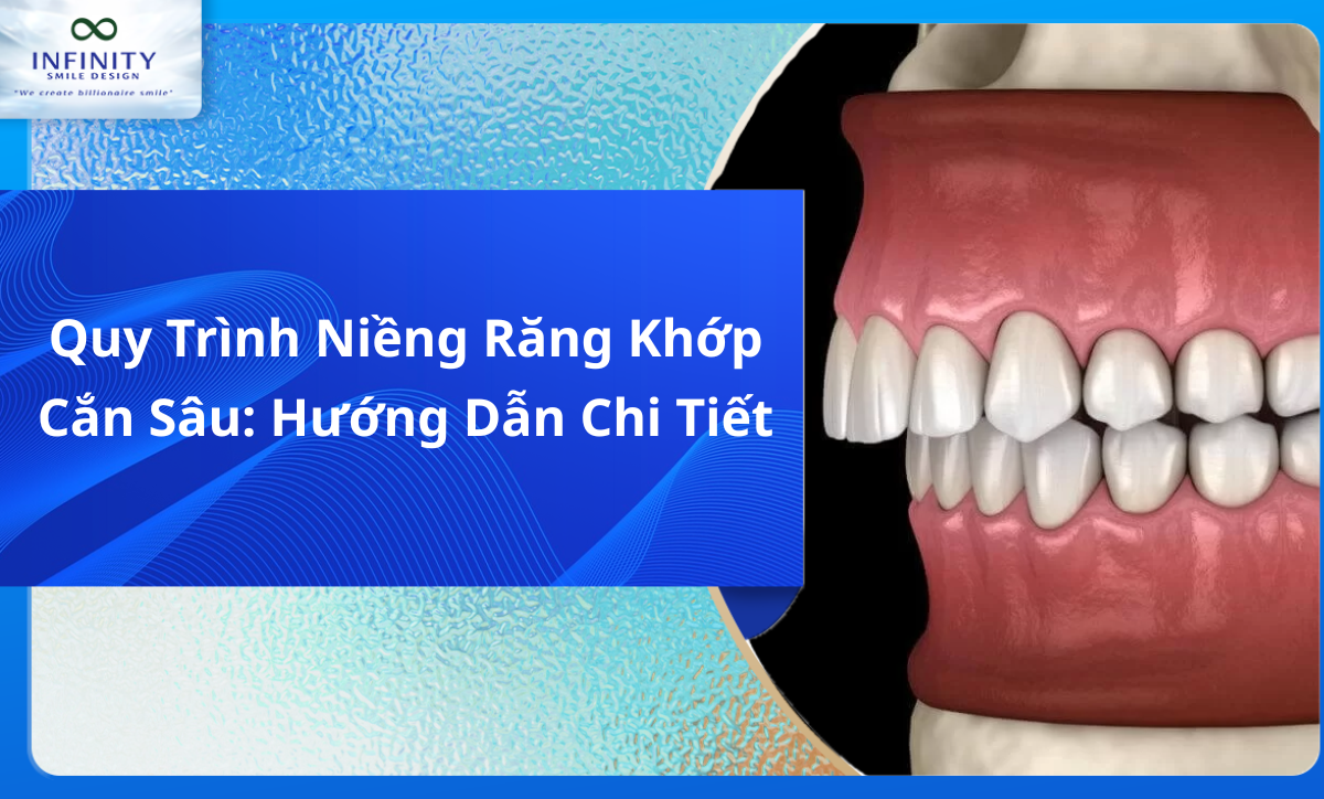 Quy Trình Niềng Răng Khớp Cắn Sâu: Hướng Dẫn Chi Tiết