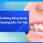 Niềng Răng Quặp: Giải Pháp Hiệu Quả Cho Nụ Cười Khỏe Mạnh