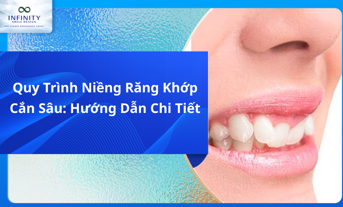 Niềng Răng Quặp: Giải Pháp Hiệu Quả Cho Nụ Cười Khỏe Mạnh