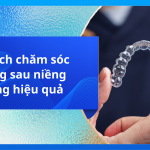 3 cách chăm sóc răng sau niềng răng hiệu quả
