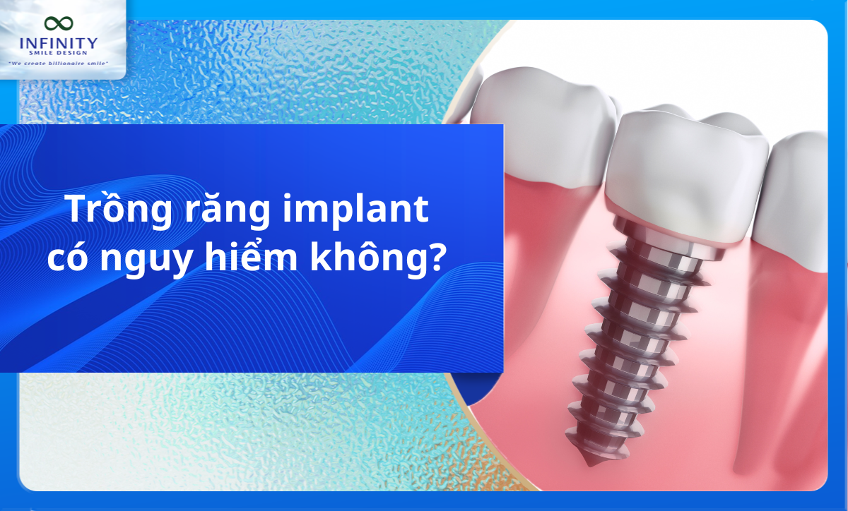 Trồng răng Implant có nguy hiểm không?