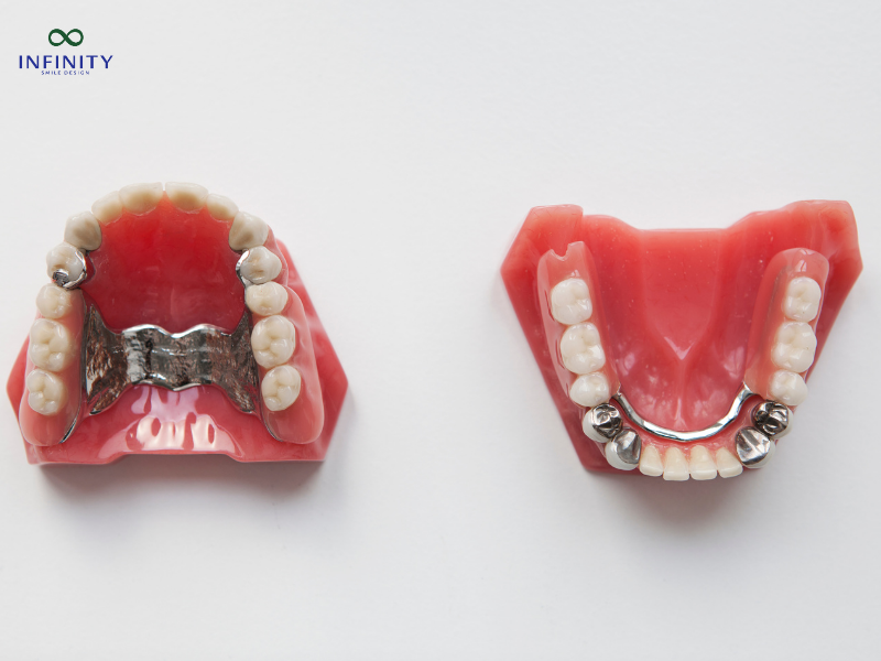 Hậu quả khi tự ý niềng răng tại nhà