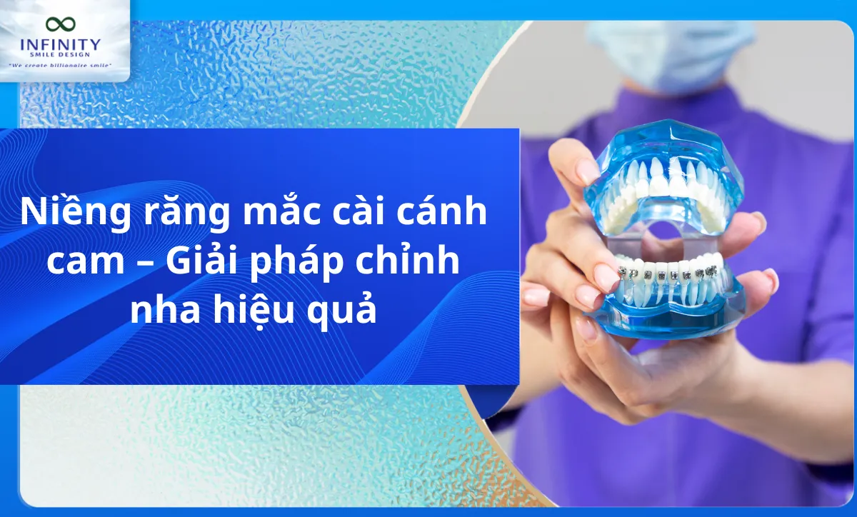 Niềng Răng Bằng Nhựa: Lựa Chọn Cho Nụ Cười Hoàn Hảo