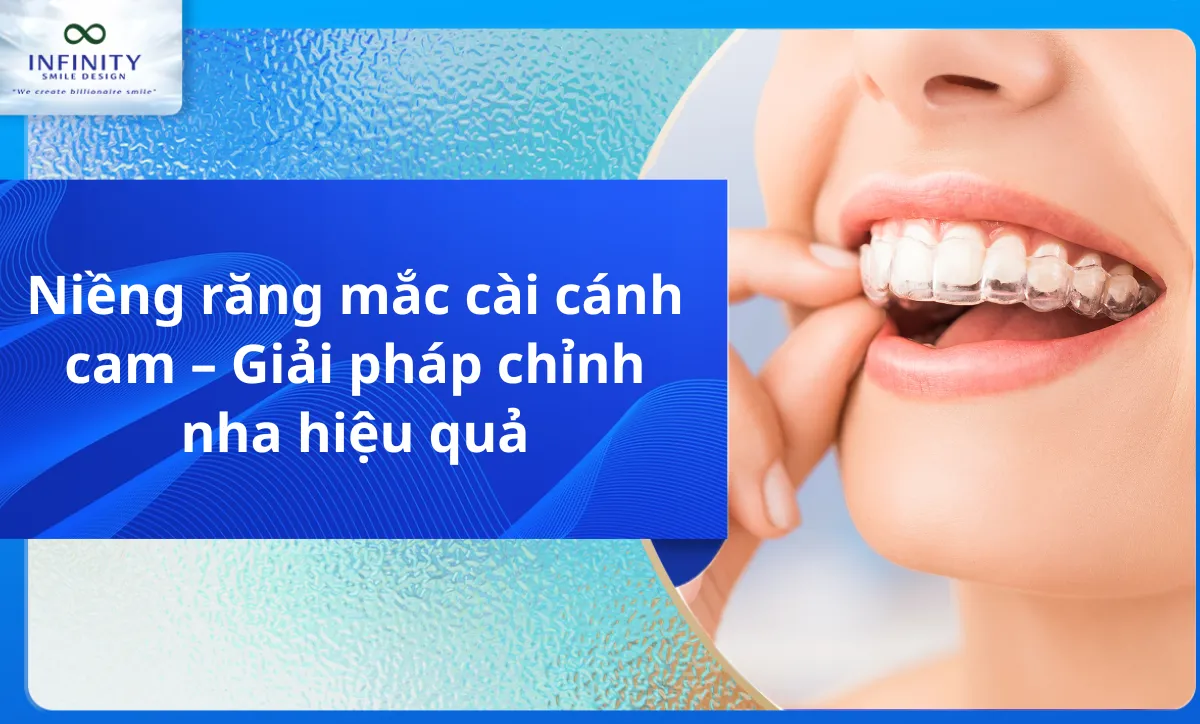 Niềng Răng Trong Suốt Invisalign: Giải Pháp Cho Nụ Cười Hoàn Hảo
