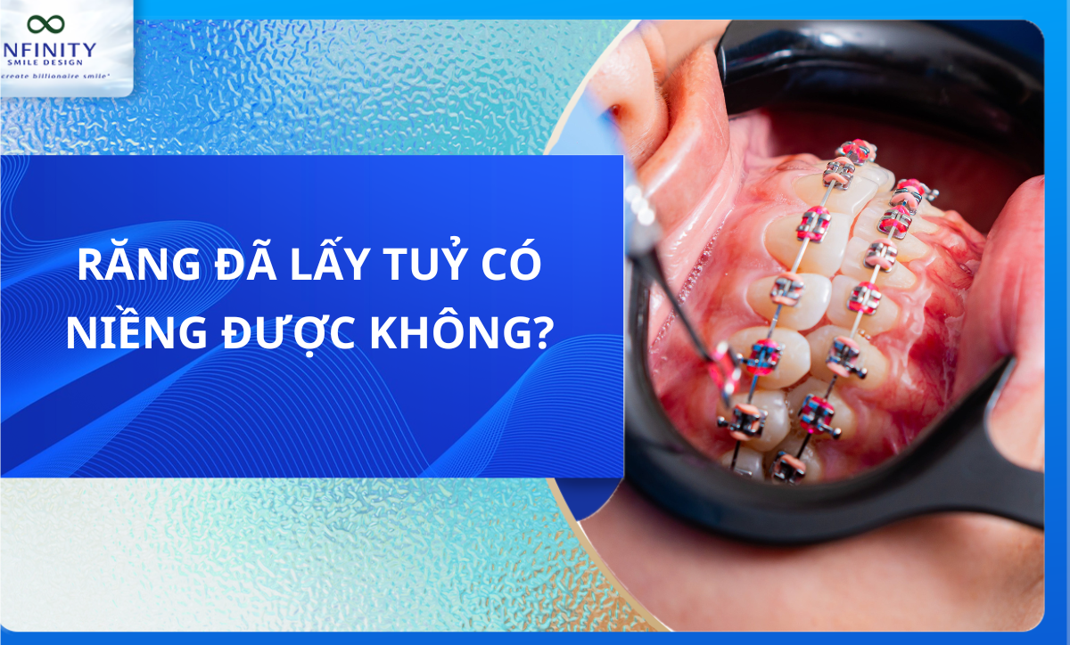 Răng đã lấy tuỷ có niềng được không?