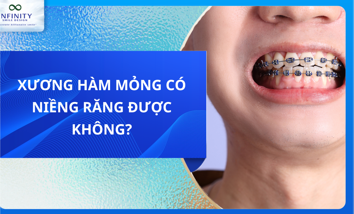 Xương hàm mỏng có niềng răng được không?