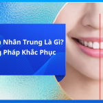 Răng Lệch Nhân Trung Là Gì? Phương Pháp Khắc Phục