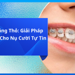 Niềng Răng Thỏ: Giải Pháp Hiệu Quả Cho Nụ Cười Tự Tin