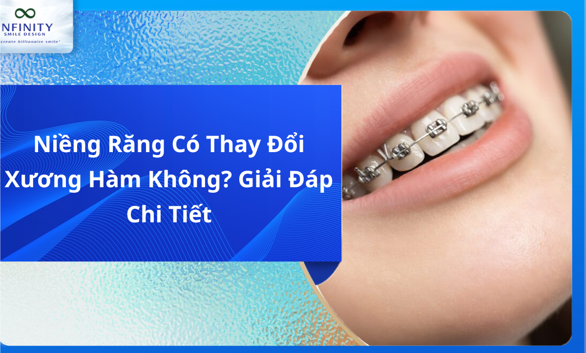 Niềng Răng Có Thay Đổi Xương Hàm Không? Giải Đáp Chi Tiết