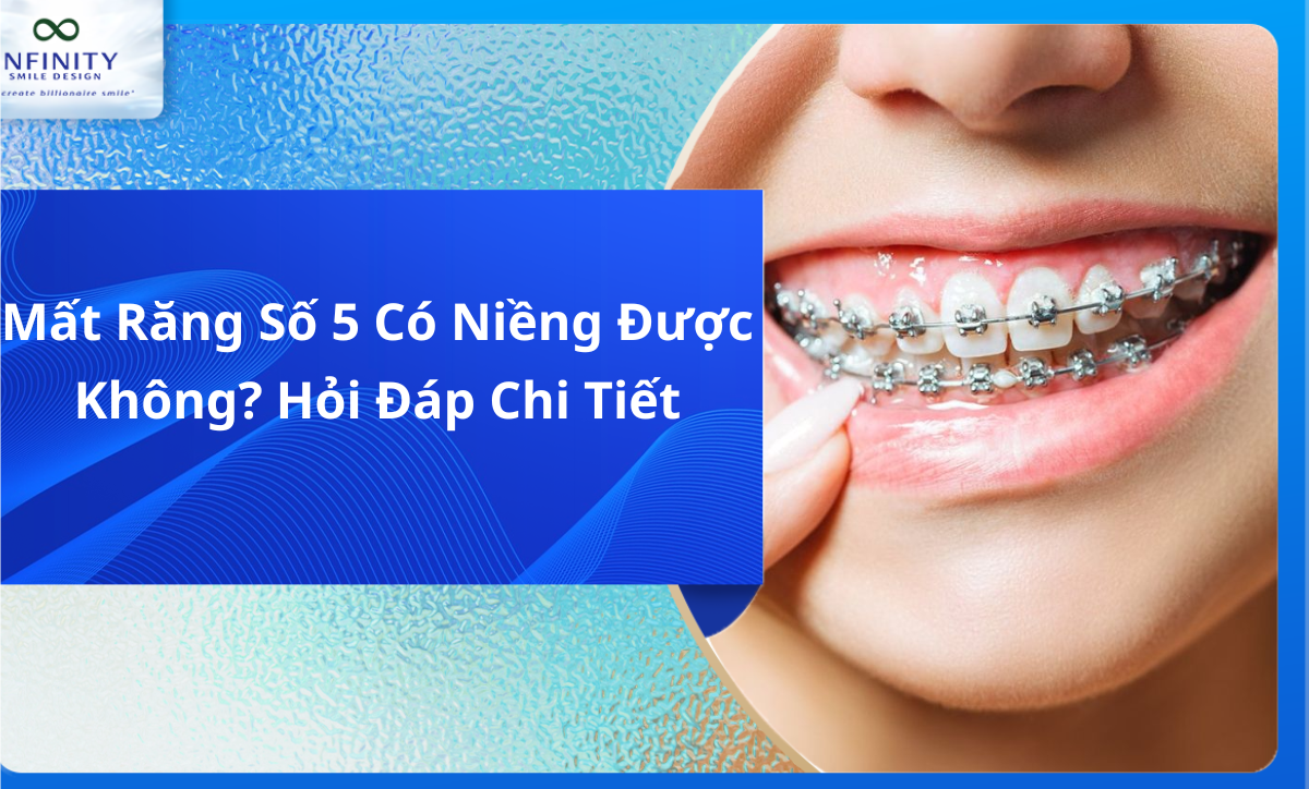 mất răng số 5 có niềng được không