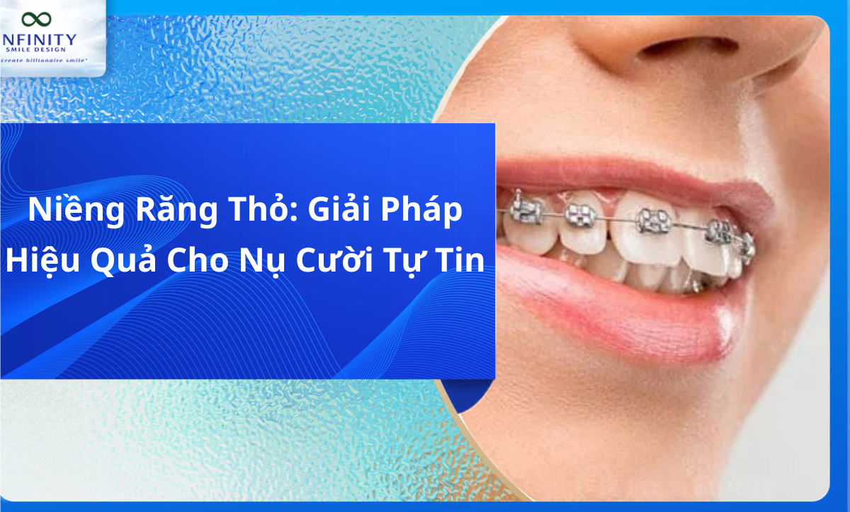 Niềng Răng Thỏ: Giải Pháp Hiệu Quả Cho Nụ Cười Tự Tin