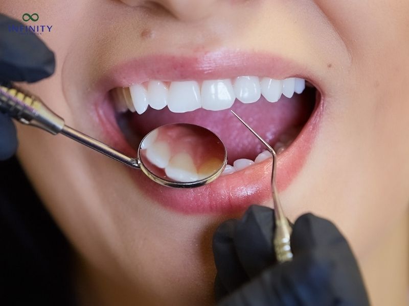 Các loại sản phẩm răng sứ và giá bọc răng sứ thẩm mỹ tại Nha khoa Infinity Smile Design