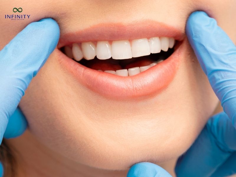 5 Dòng răng sứ phục hình răng sứ cao cấp được ưa chuộng hiện nay