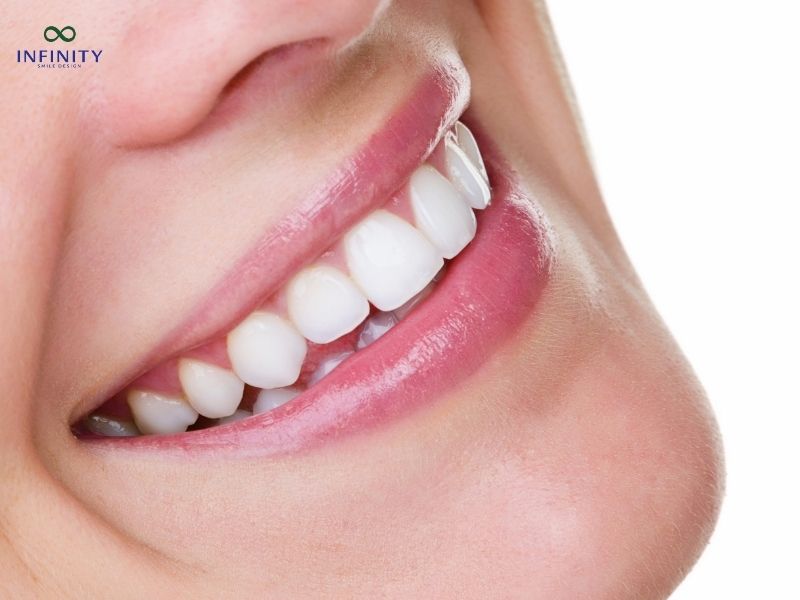 5 Dòng răng sứ phục hình răng sứ cao cấp được ưa chuộng hiện nay