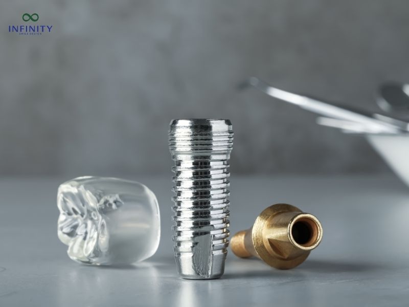 Khi nào thì trồng răng Implant?