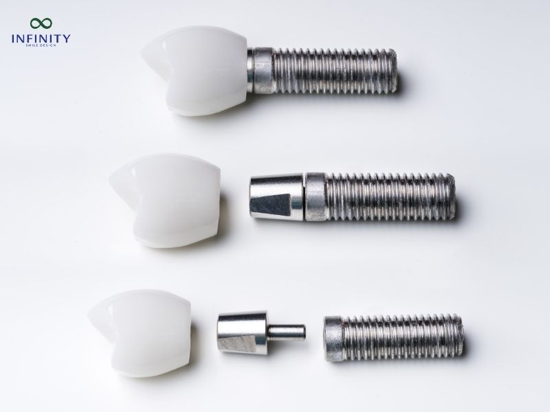 Tại sao có những trường hợp hối hận khi trồng Implant giá rẻ? Tại sao có những trường hợp hối hận khi trồng Implant giá rẻ?