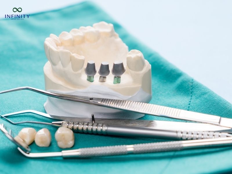 Tại sao có những trường hợp hối hận khi trồng Implant giá rẻ? Tại sao có những trường hợp hối hận khi trồng Implant giá rẻ?