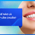 Thế nào là khớp cắn chuẩn?