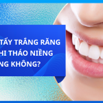 Có nên tẩy trắng răng sau tháo niềng răng