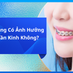 Niềng Răng Có Ảnh Hưởng Đến Thần Kinh Không?