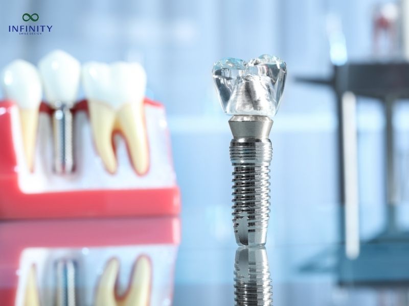Chất lượng vật liệu cao