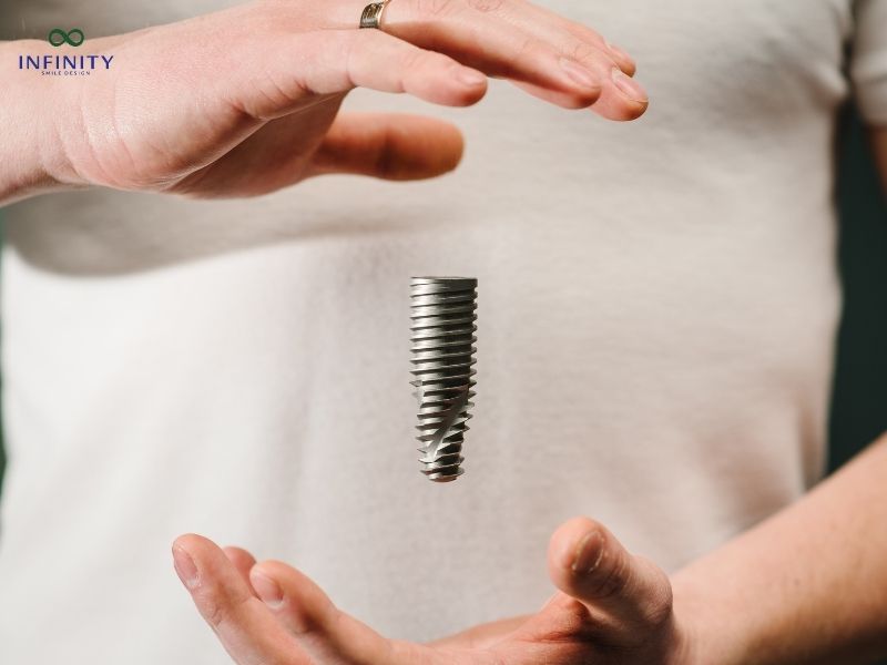 Lưu ý gì khi thực hiện trồng răng Implant?