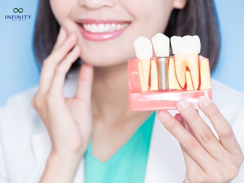 Các biến chứng sau khi cấy implant Các biến chứng sau khi cấy implant