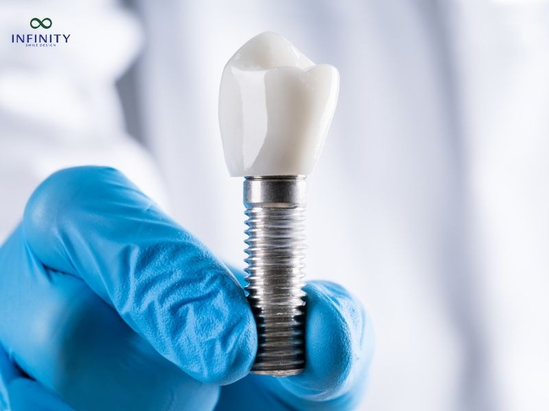 Trồng răng implant có nguy hiểm không?