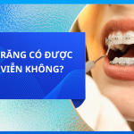 NIỀNG RĂNG CÓ ĐƯỢC VĨNH VIỄN KHÔNG?