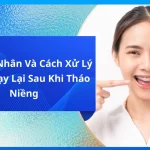 Nguyên Nhân Và Cách Xử Lý Răng Chạy Lại Sau Khi Tháo Niềng