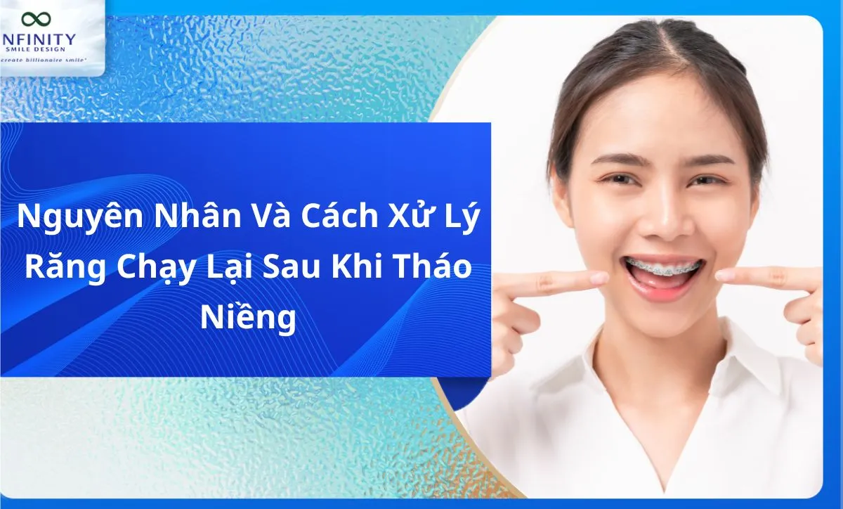 Nguyên Nhân Và Cách Xử Lý Răng Chạy Lại Sau Khi Tháo Niềng