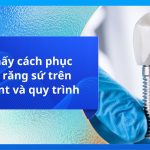 Có mấy cách phục hình răng sứ trên implant và quy trình