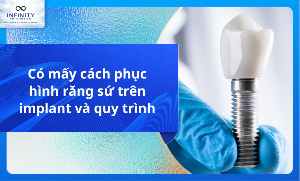 Có mấy cách phục hình răng sứ trên implant và quy trình