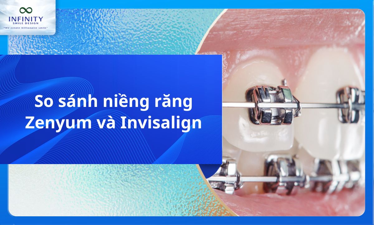 So sánh niềng răng Zenyum và Invisalign