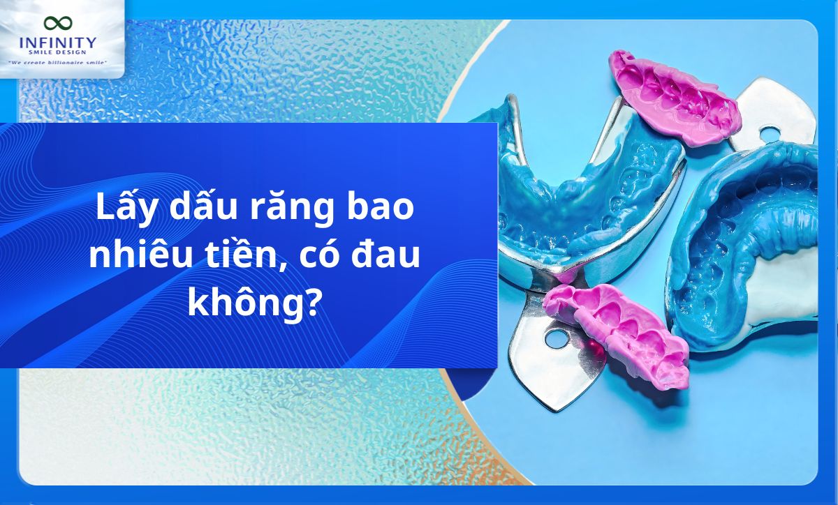 Lấy dấu răng bao nhiêu tiền, có đau không?