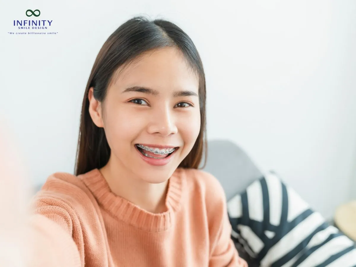 Cách sử dụng thun tách kẽ đúng cách