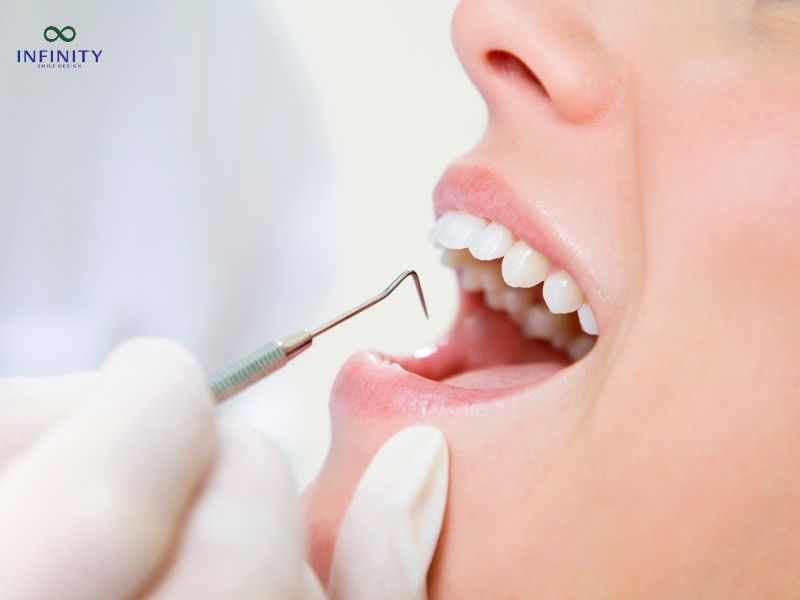 Tổng chi phí niềng răng thưa bao nhiêu tiền?