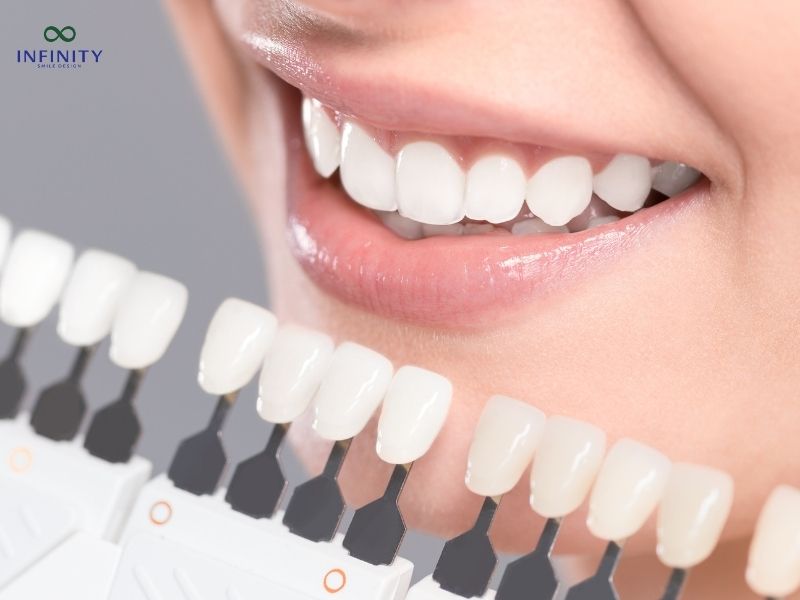 Tiêu chí đánh giá địa chỉ bọc răng sứ uy tín tại TPHCM Tiêu chí đánh giá địa chỉ bọc răng sứ uy tín tại TPHCM