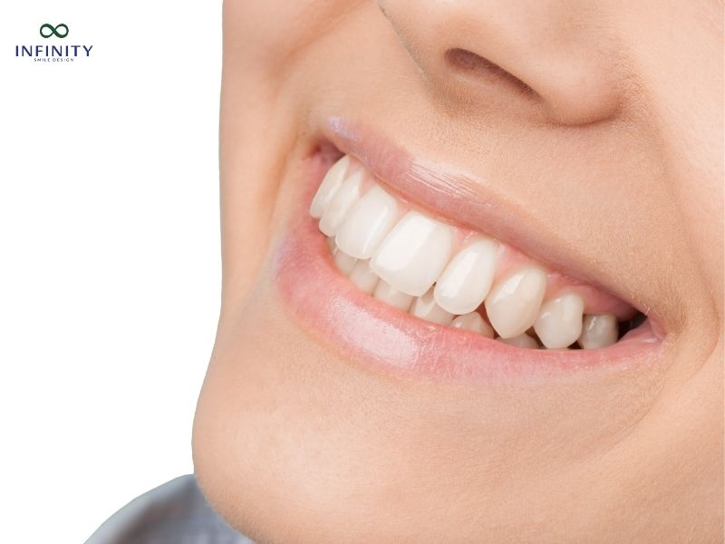 Quy trình bọc răng sứ tiêu chuẩn tại các nha khoa uy tín Quy trình bọc răng sứ tiêu chuẩn tại các nha khoa uy tín