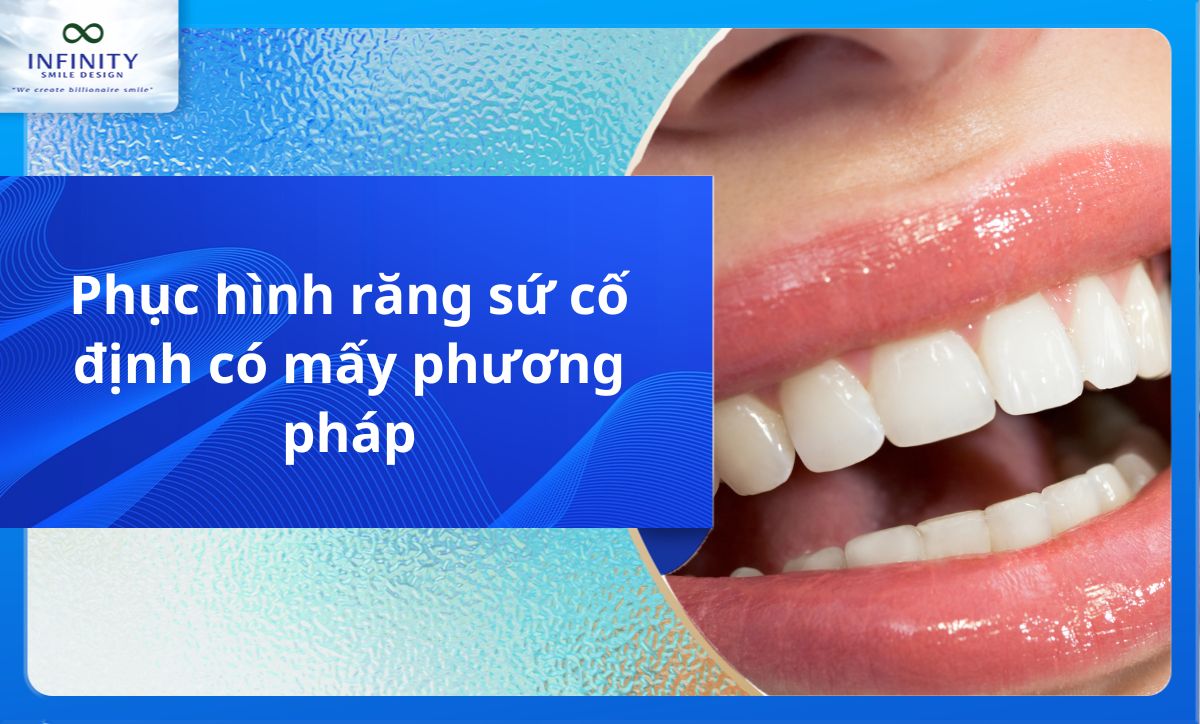 Phục hình răng sứ cố định có mấy phương pháp