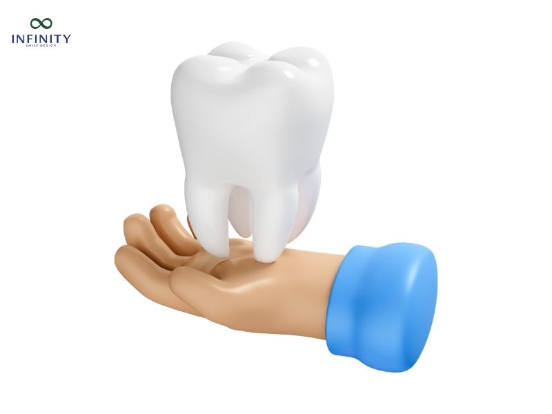 Các phương pháp niềng răng phổ biến áp dụng cho 1 răng