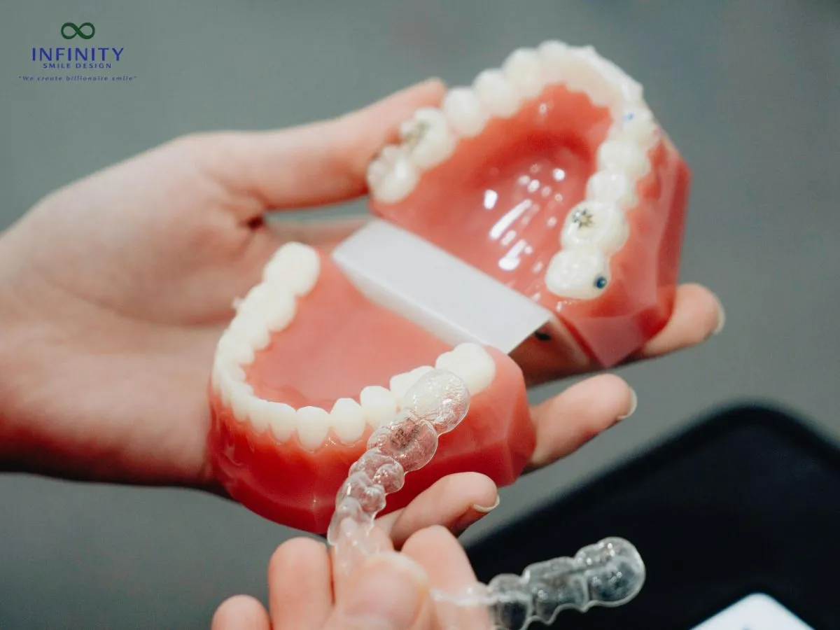 Hướng dẫn sử dụng và chăm sóc hàm duy trì đúng cách