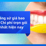 Bọc răng sứ giá bao nhiêu? Chi phí trọn gói mới nhất hiện nay