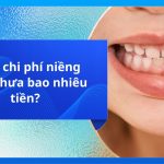 Tổng chi phí niềng răng thưa bao nhiêu tiền?
