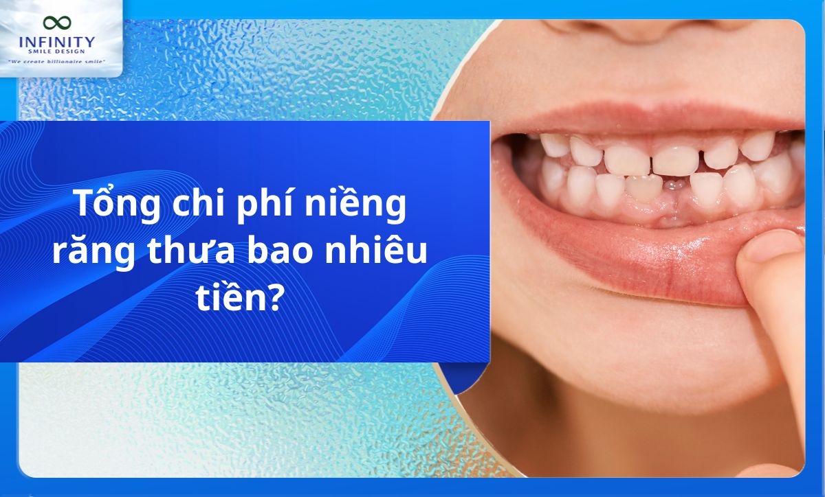 Tổng chi phí niềng răng thưa bao nhiêu tiền?