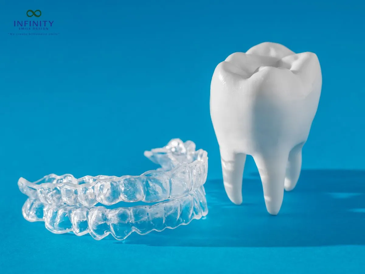 Niềng Răng Silicon - Giải Pháp Chỉnh Nha Thẩm Mỹ Hiện Đại 2 Quy trình sử dụng niềng răng silicon