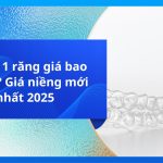 Niềng 1 răng giá bao nhiêu? Giá niềng mới nhất 2025