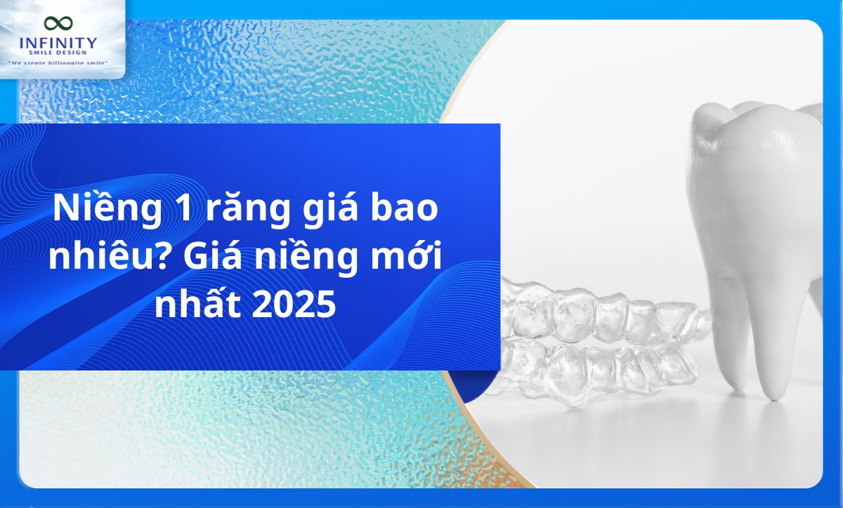 Niềng 1 răng giá bao nhiêu? Giá niềng mới nhất 2025